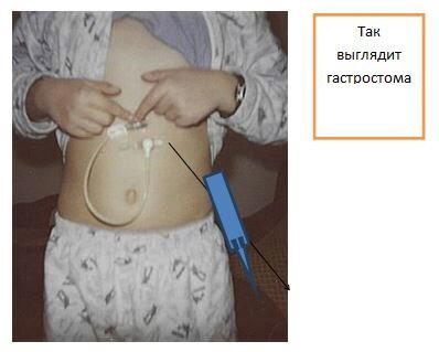Моя жизнь или почему именно Я?