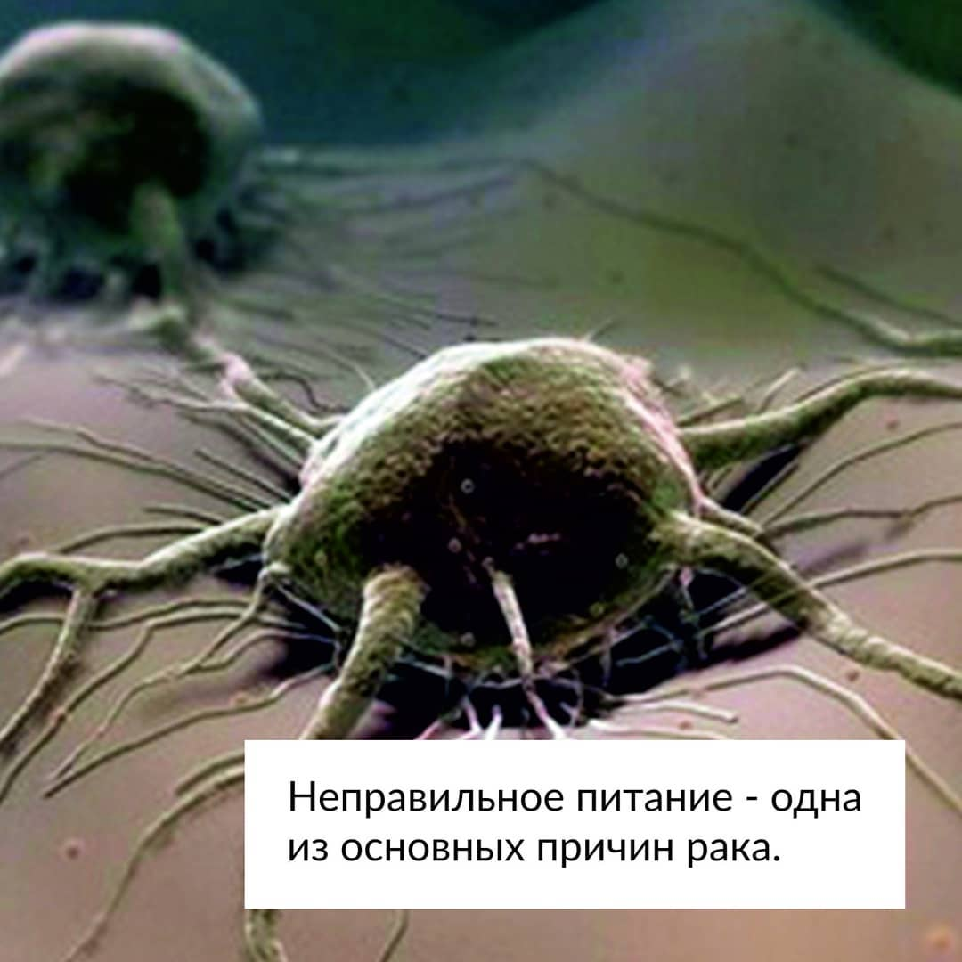 Неправильное питание — одна из основных причин рака