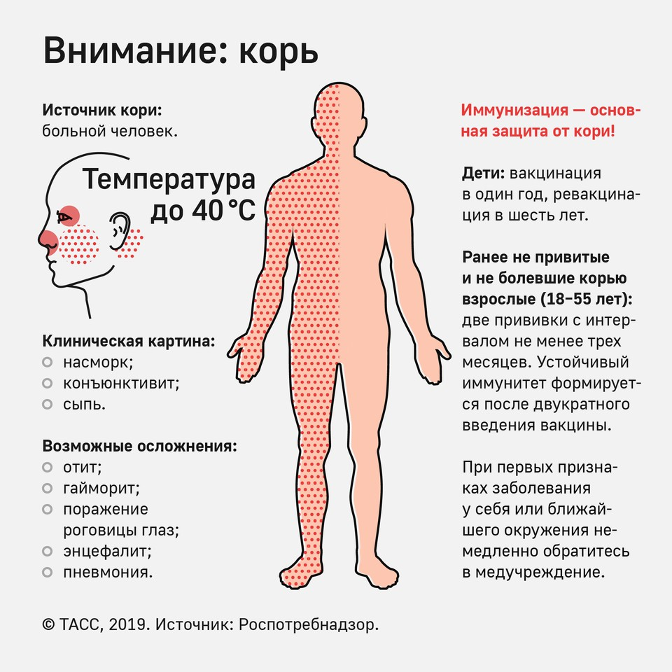Более 50 детей умерли в Самоа от эпидемии кори