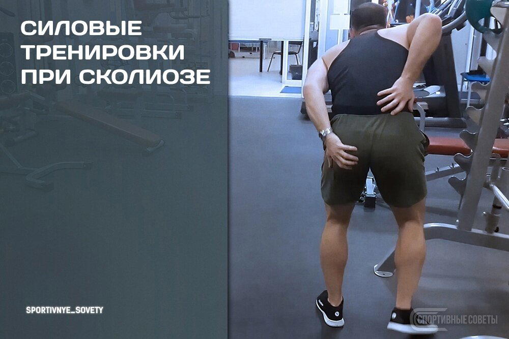 Силовые тренировки при сколиозе