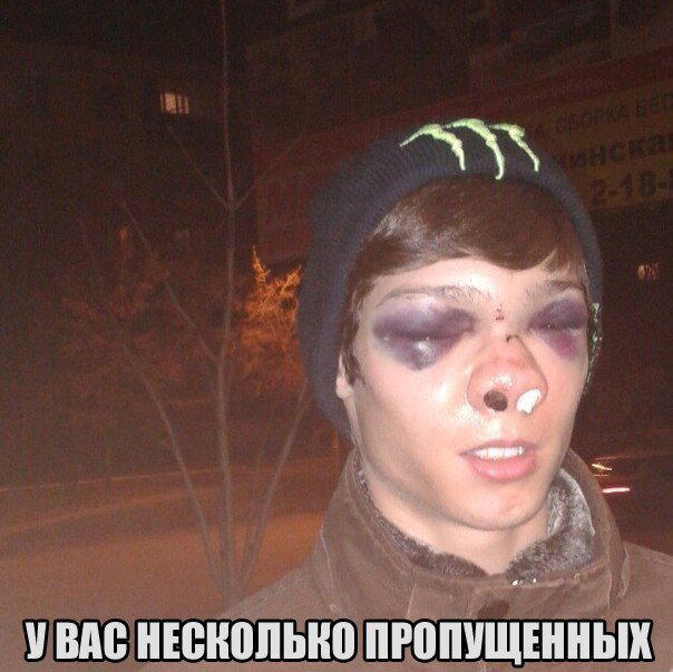 Коротко о травмах или как пельмени помогают при ушибах
