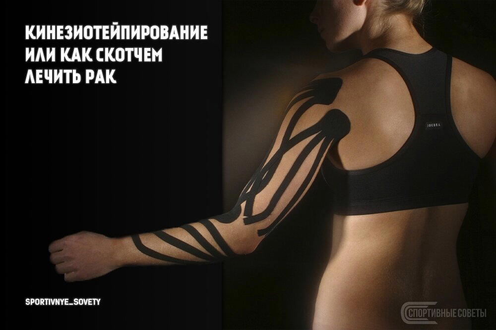 Кинезиотейпирование или как скотчем лечить рак