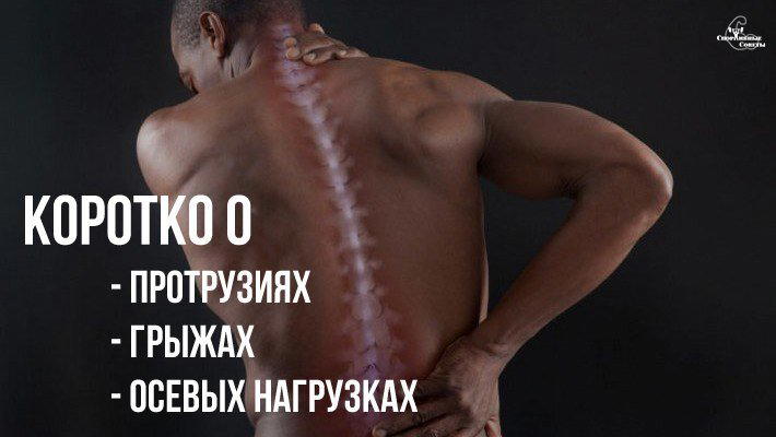 Коротко о протрузиях, грыжах и осевых нагрузках