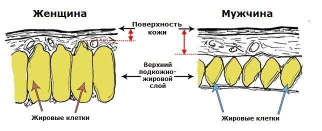Целлюлит: как, зачем и почему?