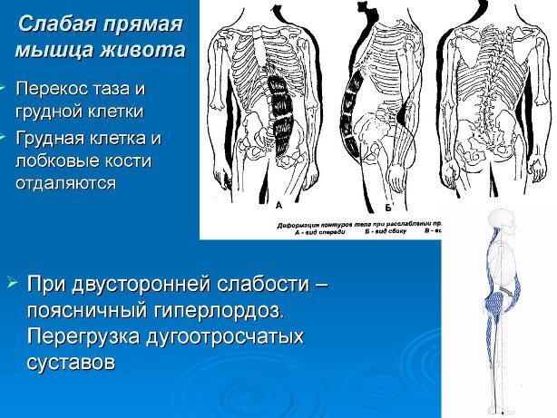 Так ли полезен «вакуум» в животе? (очередной секрет)