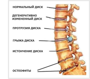 Нейтральное положение позвоночника