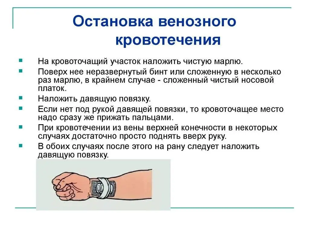 Урок №5 Венозное кровотечение, безопасность и способы остановки (часть вторая)
