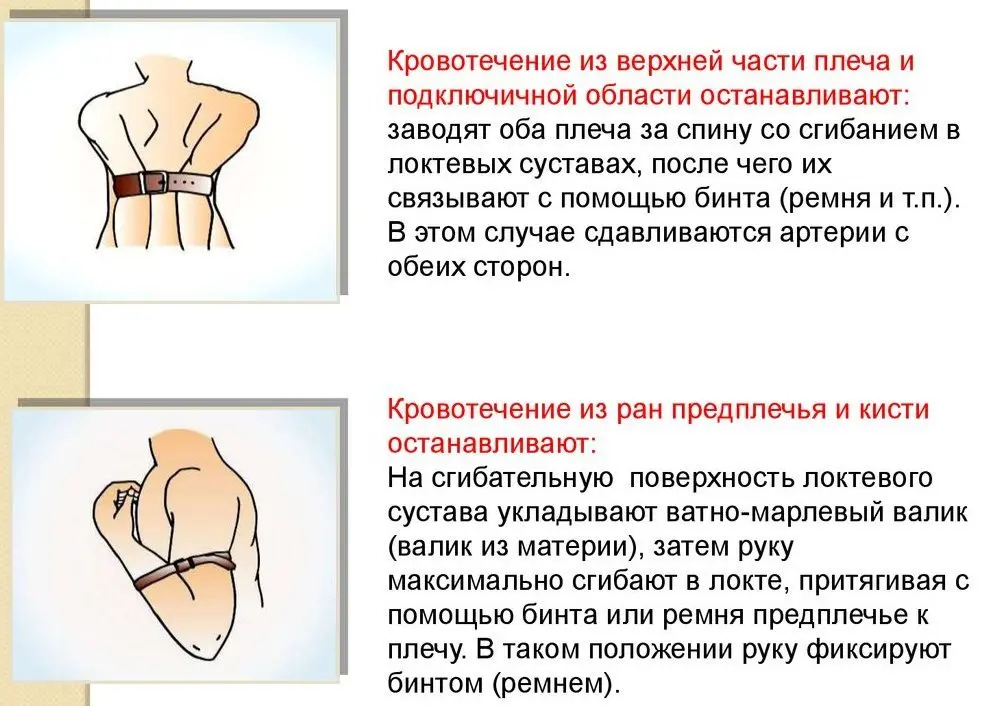 Урок №5 Венозное кровотечение, безопасность и способы остановки (часть вторая)