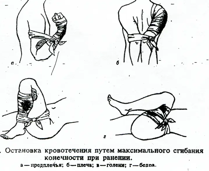 Урок №5 Венозное кровотечение, безопасность и способы остановки (часть вторая)
