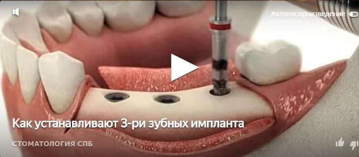 Заголовок к видео просто фееричен!