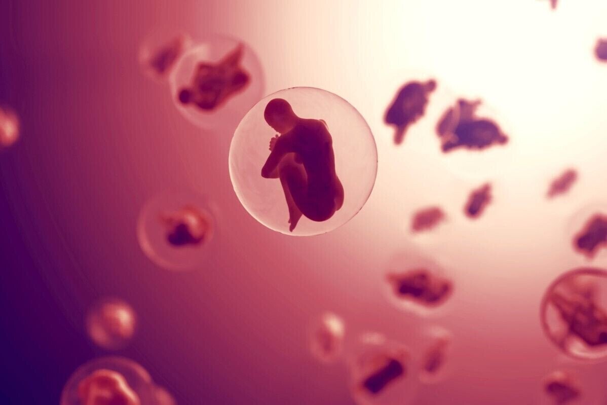© 