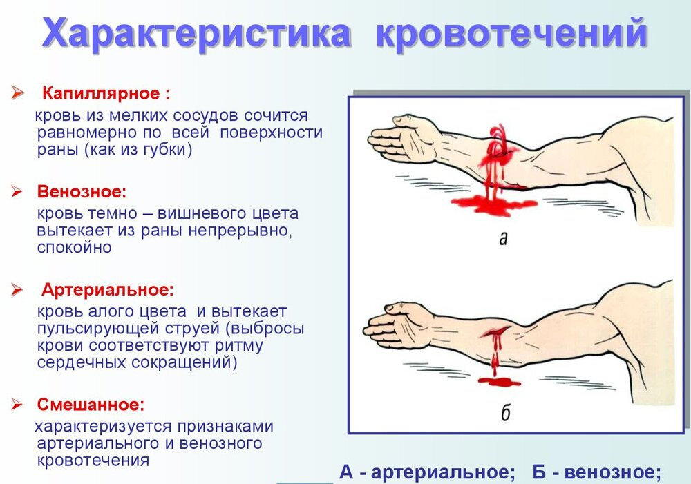 Урок №8 Артериальные кровотечения