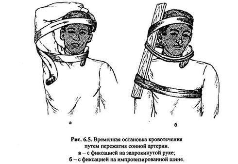 Урок №6. Повреждения вен шеи. Особенности оказания помощи.