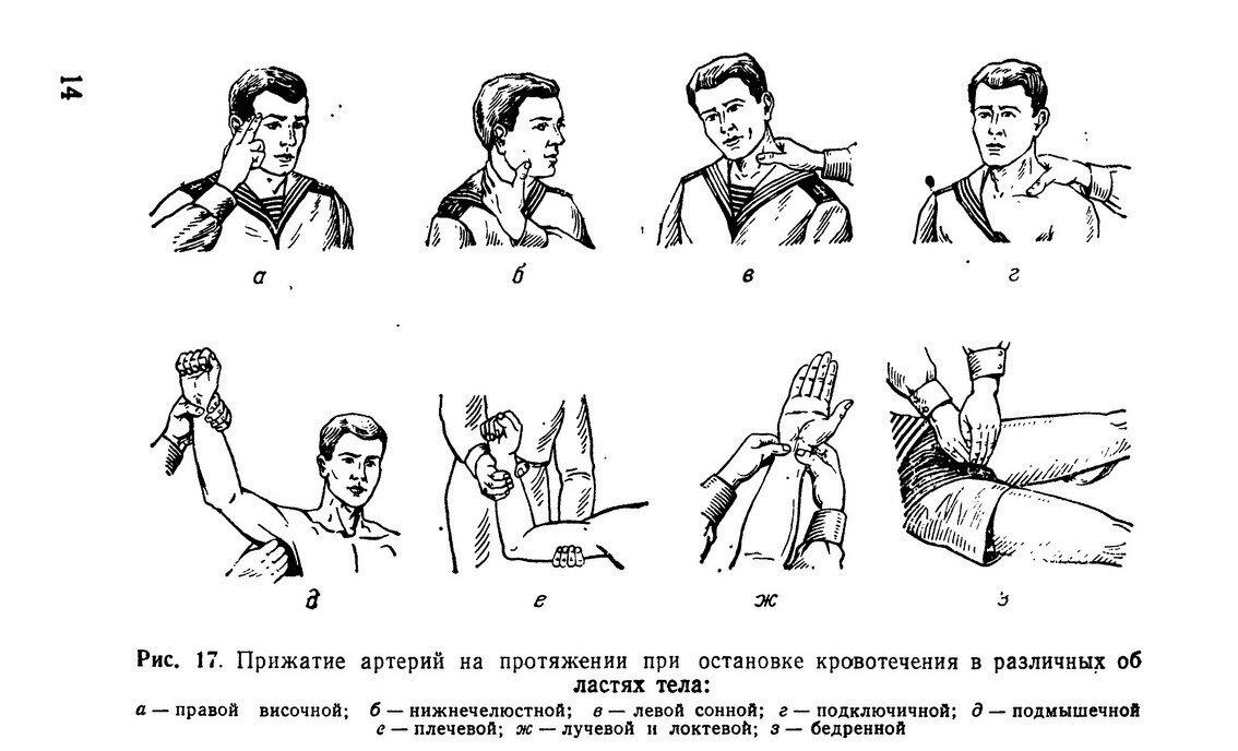 Урок №9 Первая помощь при сильном кровотечении. Часть первая.
