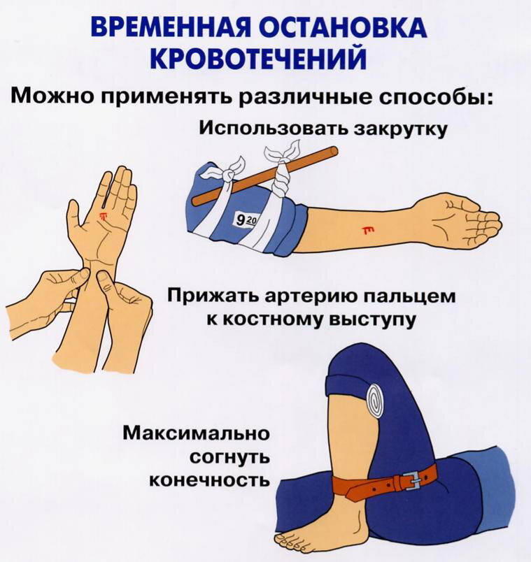 Урок №13 Первая помощь при сильном кровотечении. Часть пятая