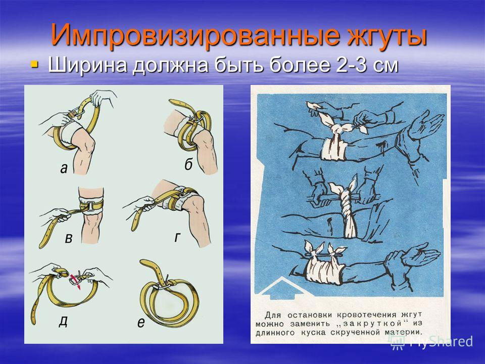 Урок №11 Первая помощь при сильном кровотечении. Часть третья
