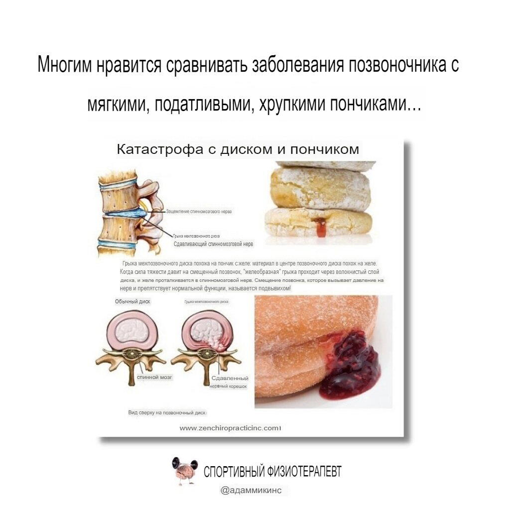 Про межпозвонковые диски