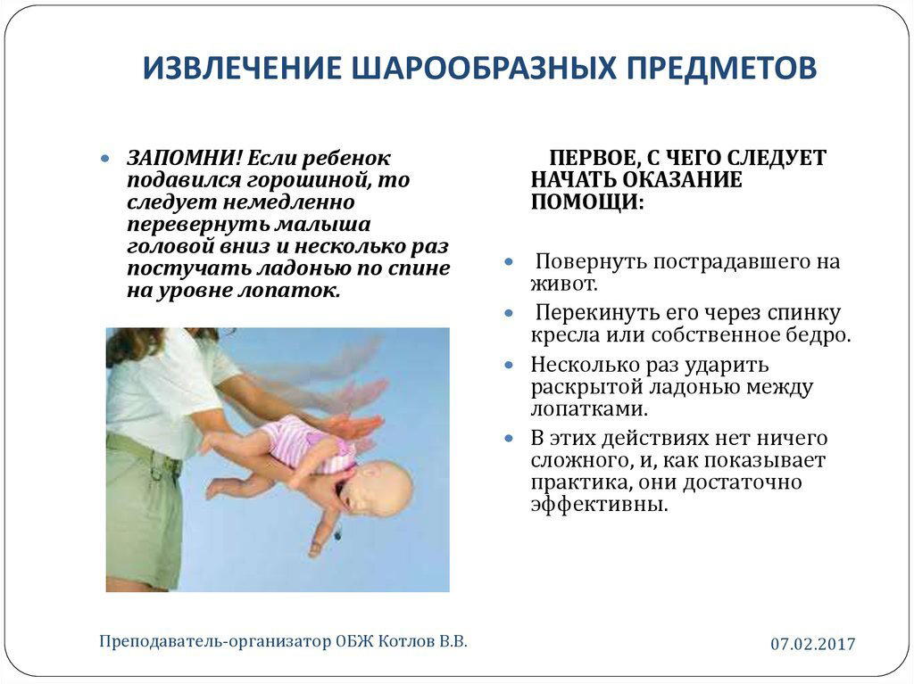 Прием Геймлиха детям