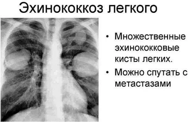 Опасность заражения эхинококком от собак: как защитить себя и своих близких
