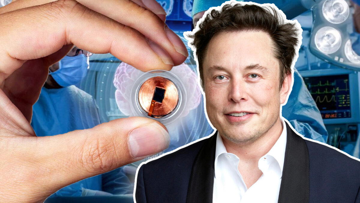 Стартап Илона Маска Neuralink успешно вживил чип в мозг первому пациенту