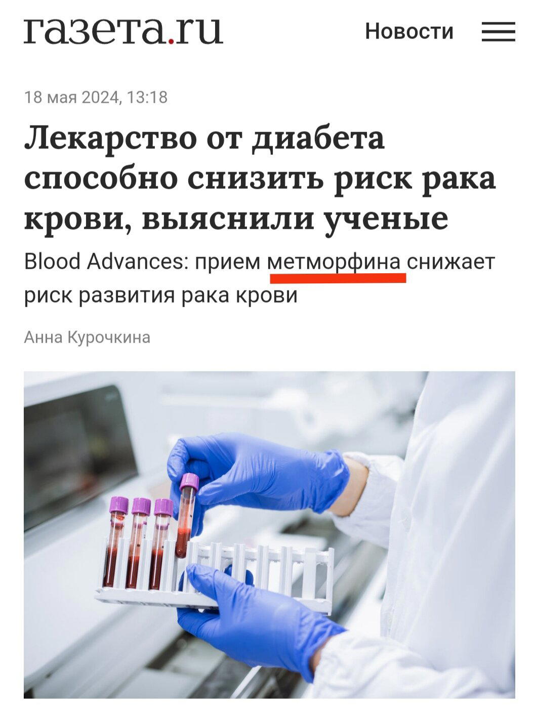 Что у журналистов на уме