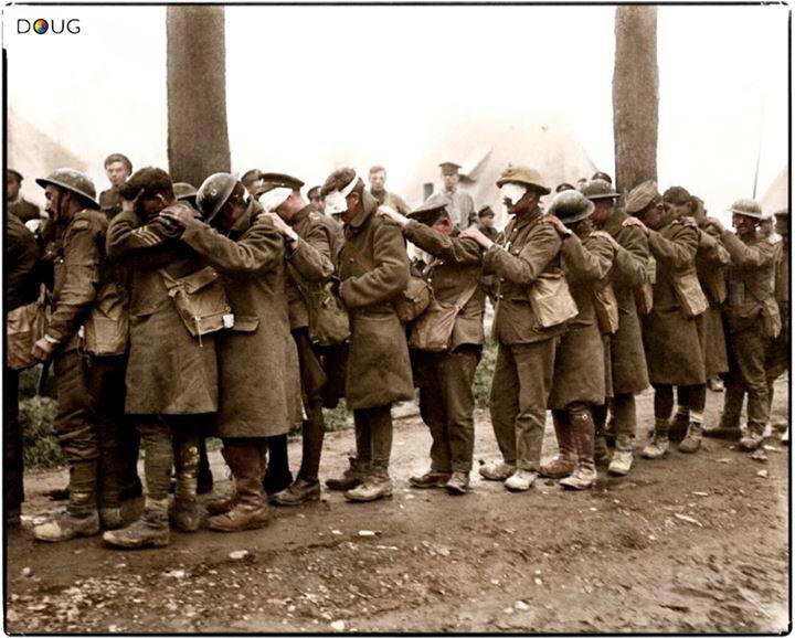 Британские солдаты 55 дивизии, ослепленные газом. 10 апреля 1918 года