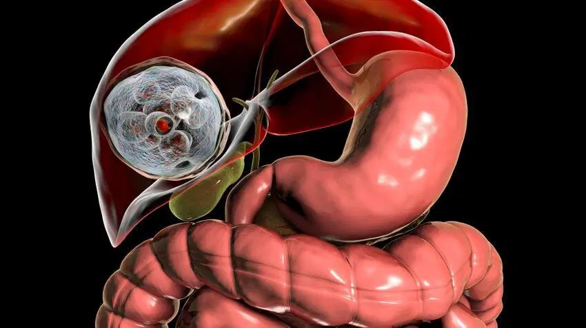 Черви, которые вас убьют (вернее их личинки)⁠