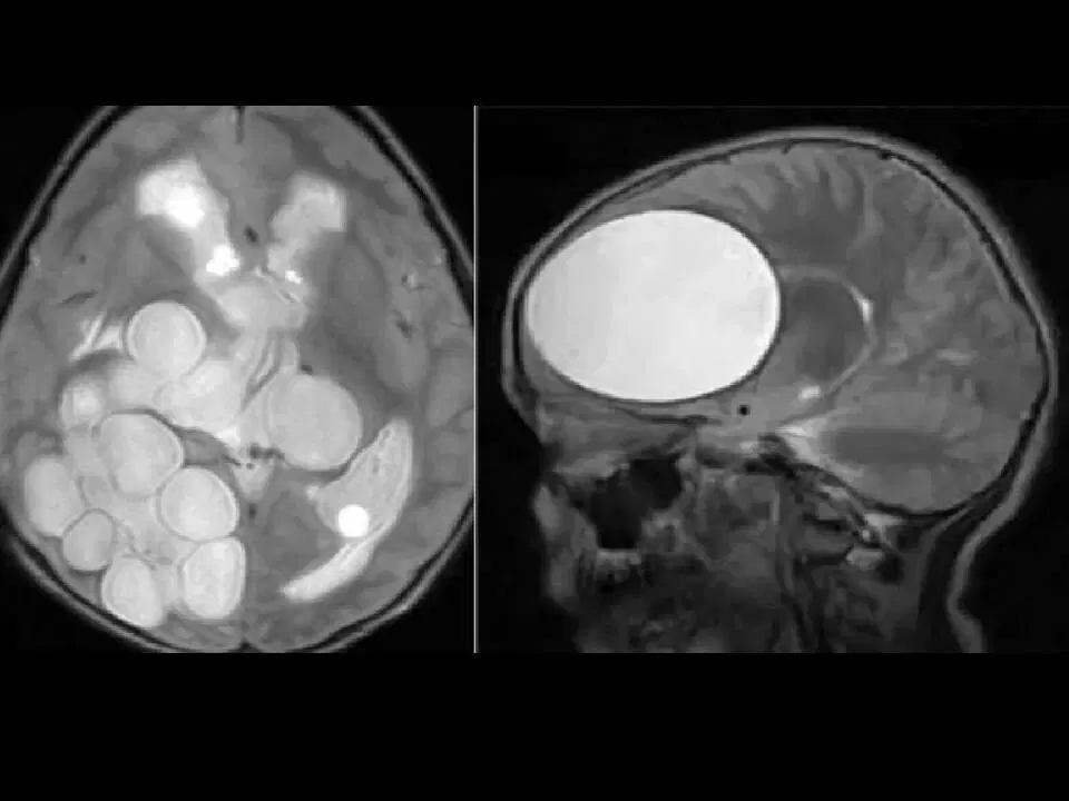 Черви, которые вас убьют (вернее их личинки)⁠