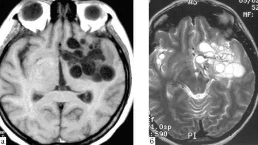 Черви, которые вас убьют (вернее их личинки)⁠