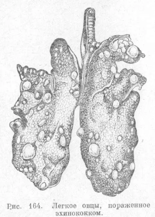 Черви, которые вас убьют (вернее их личинки)⁠