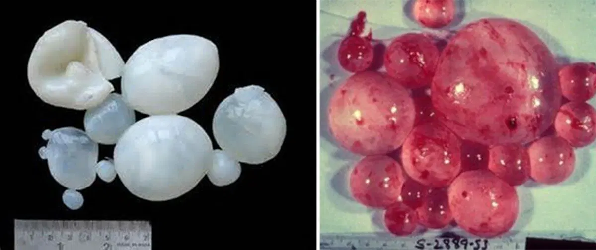 Черви, которые вас убьют (вернее их личинки)⁠