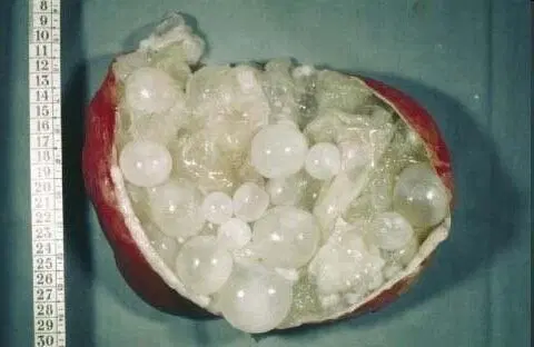 Черви, которые вас убьют (вернее их личинки)⁠