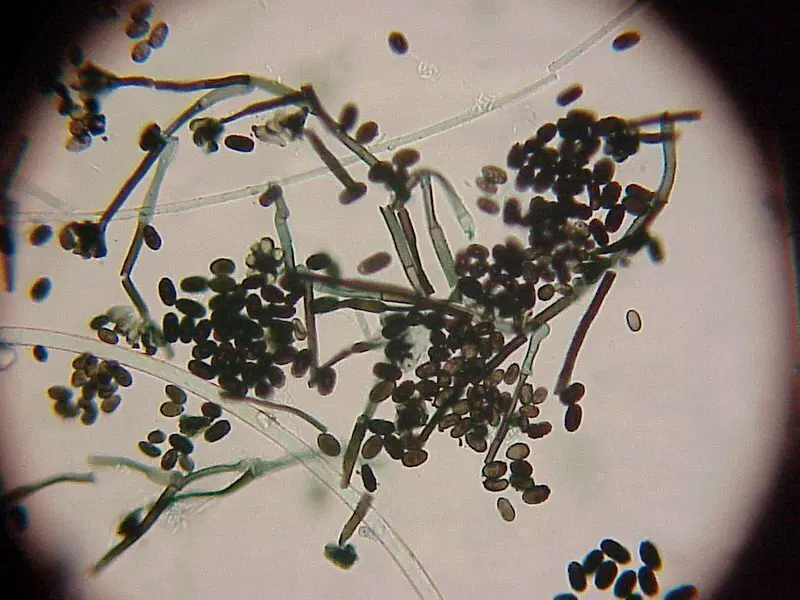 Черная плесень. Домашний тлен и токсины. Как ее победить?