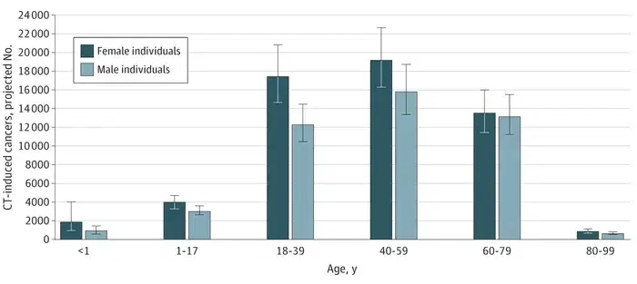 Компьютерная томография может быть ответственна за 5% онкологических заболеваний