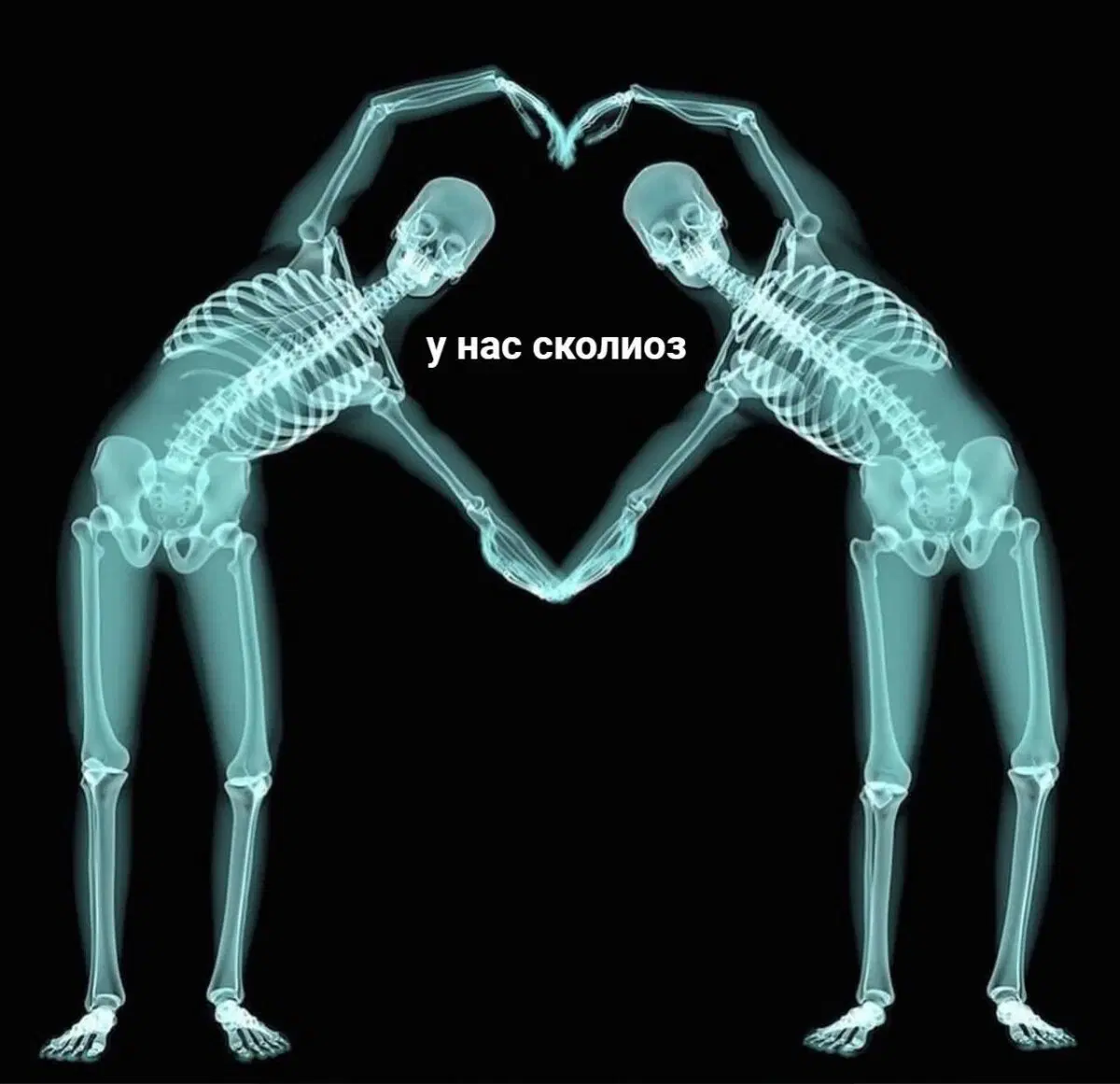 Жизнь скучна, живите с дичью