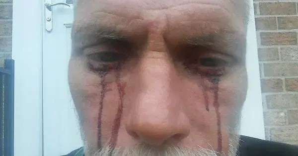 Британские учёные определили по пыли с документов, что у Дракулы была гемолакрия. Это когда кровавыми слезами плачут. Ух, упыряка, с кровавыми слезами!