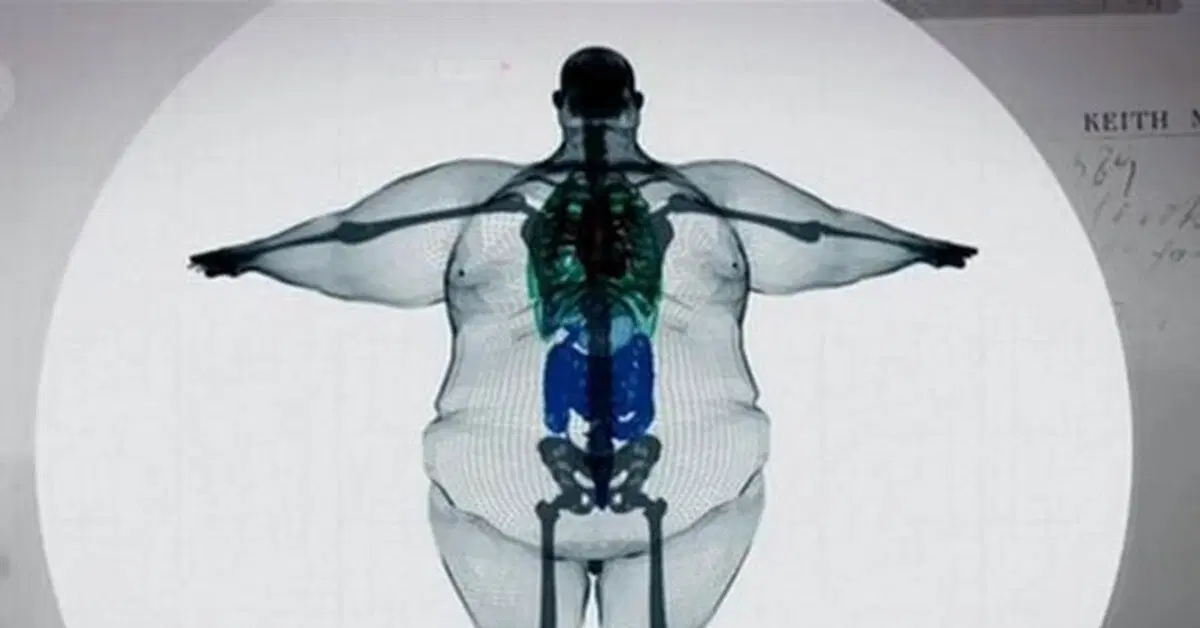 Немного про "широкую кость" и жир из ниоткуда