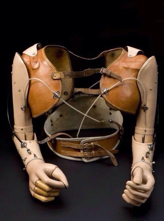 Протез верхних конечностей сделанный для 17-летнего американского мальчика в 1959 году.