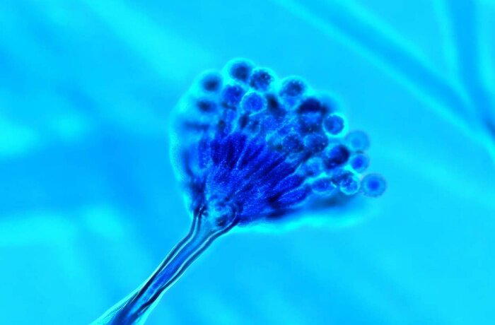 Aspergillus calidoustus под микроскопом. На снимке видны небольшая везикула, двухъярусные конидиогенные клетки и шероховатые конидии — структуры, с помощью которых гриб образует и распространяет споры. Увеличение примерно в 1 000 раз, окрашивание лактофеноловым хлопковым синим / © thunderhouse4-yuri.blogspot.com