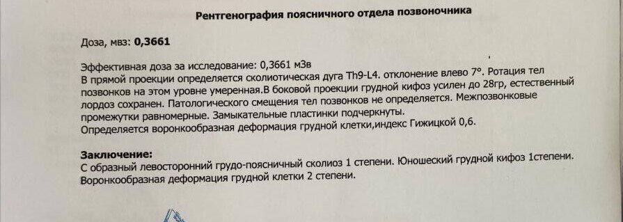 Воронкообразная деформация грудной клетки